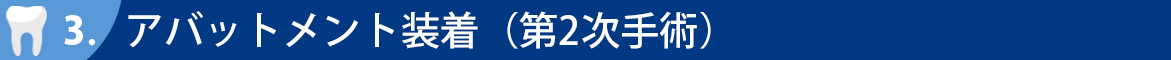 アバットメント装着（第2次手術）