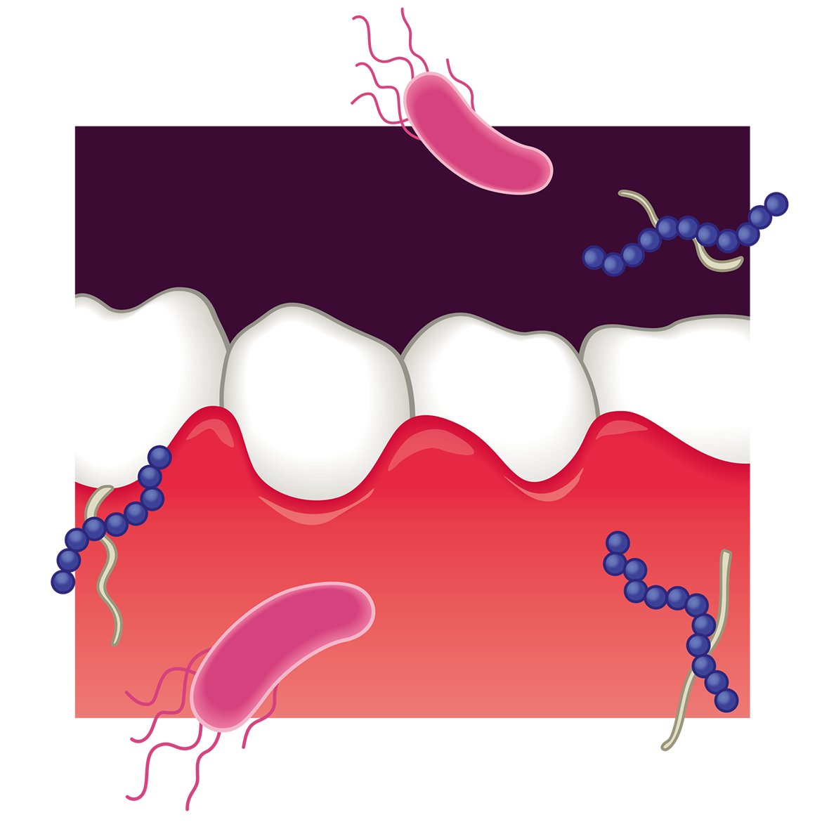 イラスト：口の中の細菌のイメージ