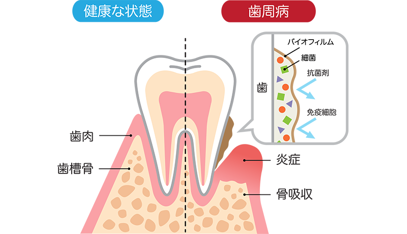 イラスト：比較のイメージ